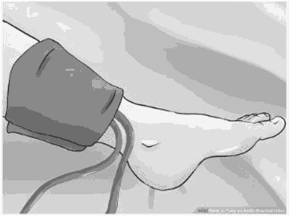 Posi&#56256&#56735oning of the blood pressure monitoring cuff on the ankle/ lower calf.